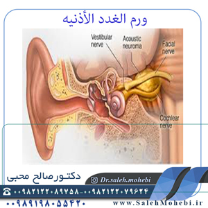 اورام الاذن