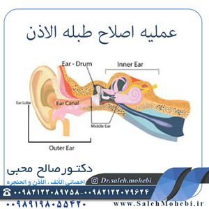 عملیه اصلاح طبله الاذن