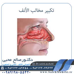 تکبیر مخالب الأنف