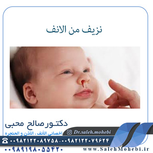 نزیف-من-الانف