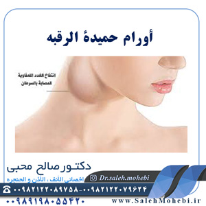 أورام حميدة الرقبه    