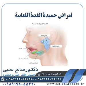 أمراض حميدة الغدة اللعابية
