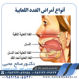 أنواع أمراض الغدد اللعابية         