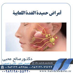 أمراض حميدة الغدة اللعابية