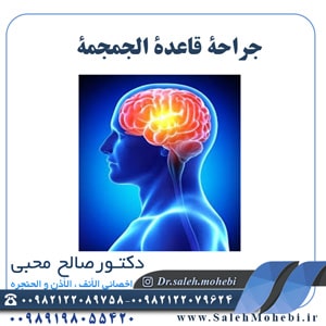 جراحة قاعدة الجمجمة