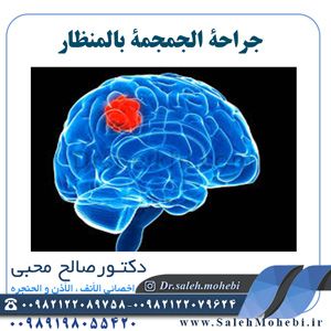 جراحة الجمجمة بالمنظار                 
