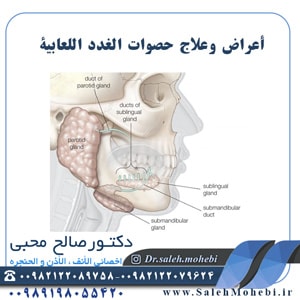 أعراض وعلاج حصوات الغدد اللعابية