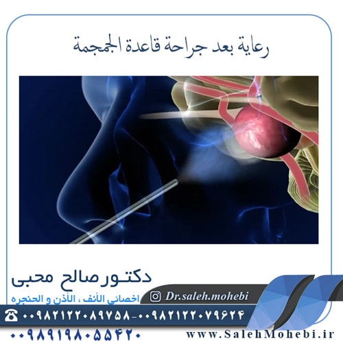 رعاية بعد جراحة قاعدة الجمجمة