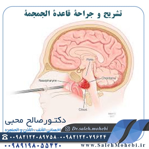 تشريح و جراحة قاعدة الجمجمة