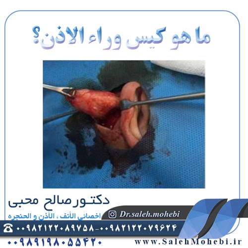 ما هو كيس العنق؟
