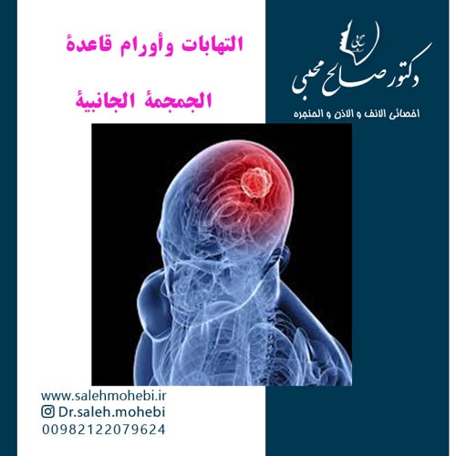 التهابات وأورام قاعدة الجمجمة الجانبية