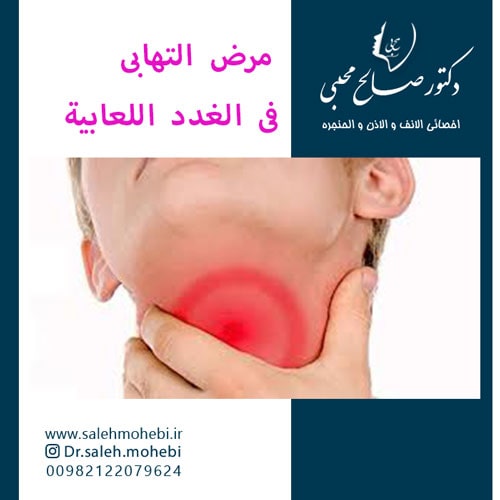 مرض التهابي في الغدد اللعابية