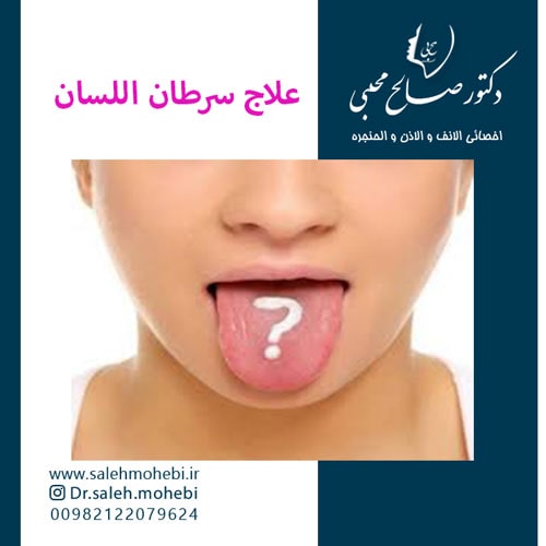 علاج سرطان اللسان